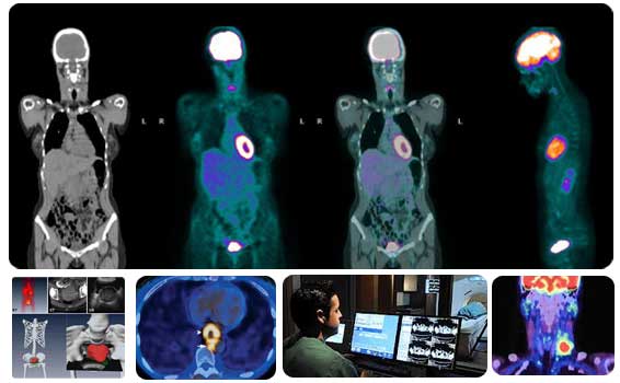 تصویر برداری petct پت اسکن
